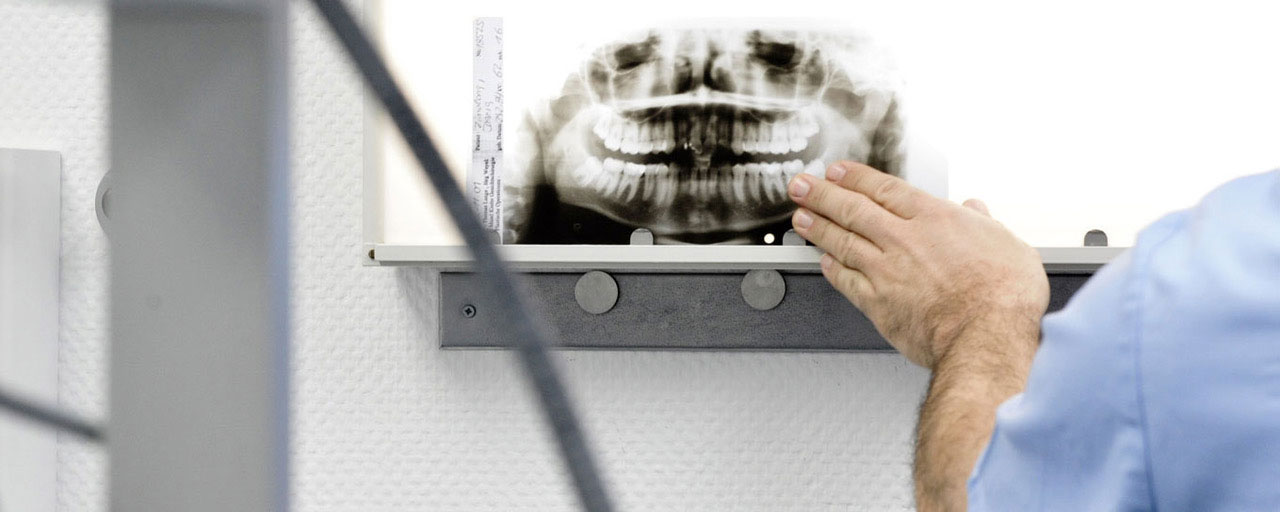 Geschädigter Zahn: Wurzelbehandlung oder Implantat?