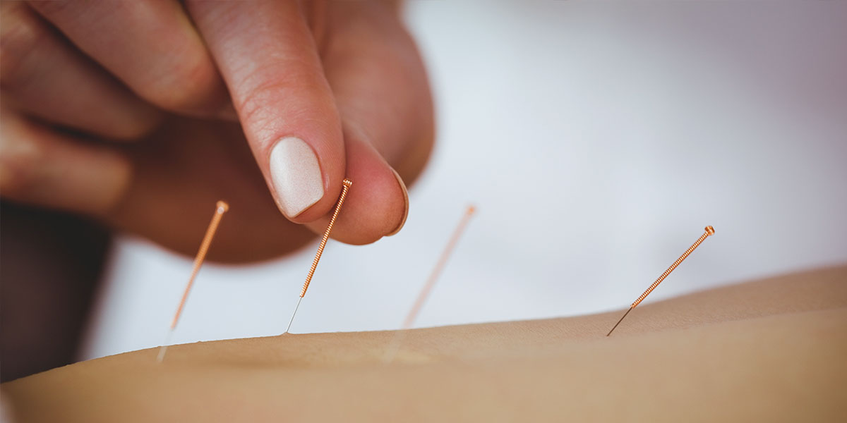 Angst vor der (Zahn)Behandlung: Hilft Akupunktur?