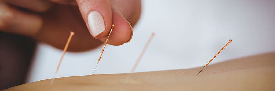 Angst vor der (Zahn)Behandlung: Hilft Akupunktur?